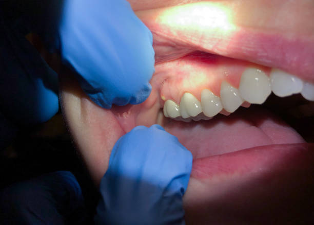 Best Pediatric Emergency Dentist in Sonora, CA