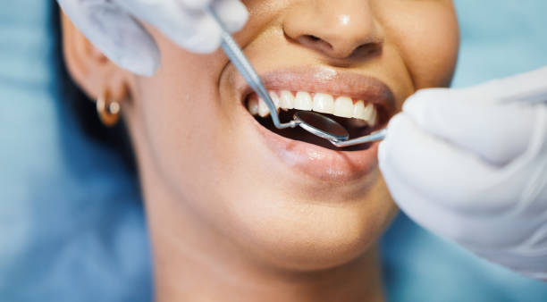 Best Emergency Gum Treatment in Sonora, CA